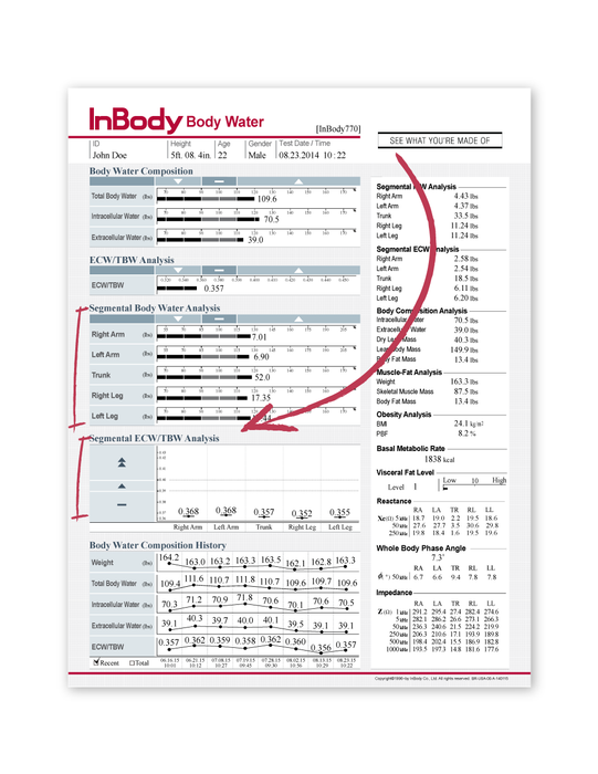InBody 770 Body Composition Analyser Package
